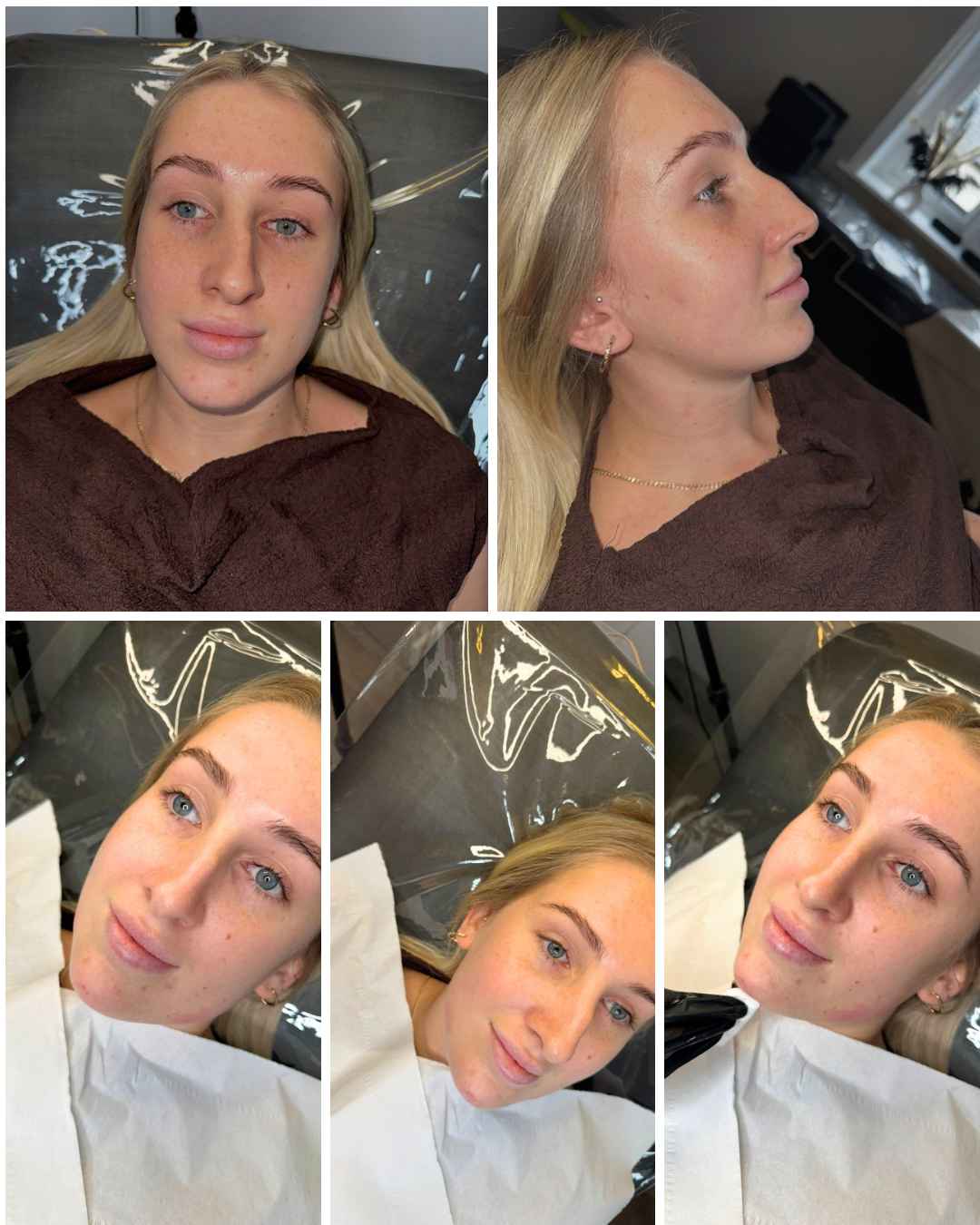 Clinical Result