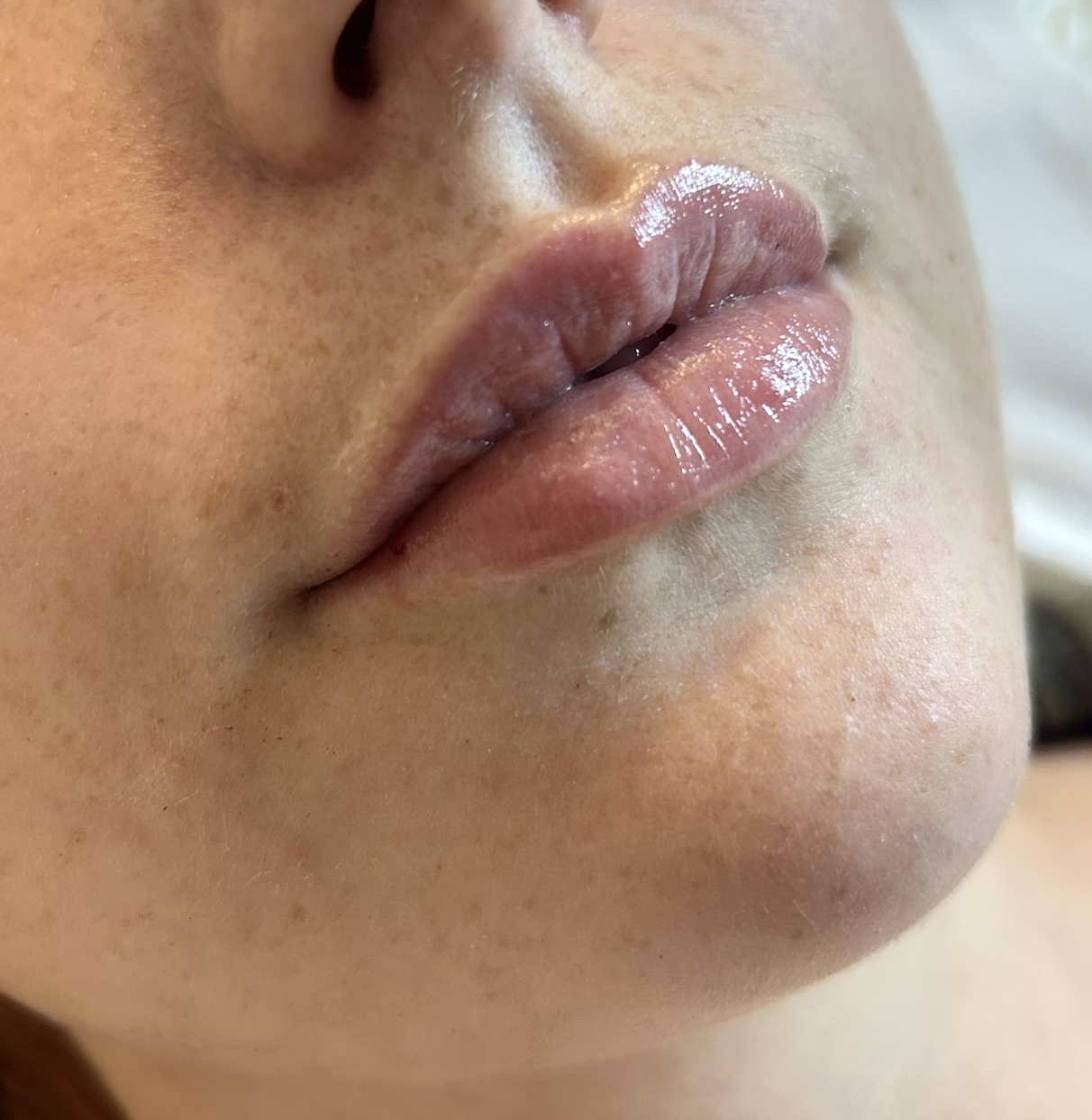 Treatment Visual