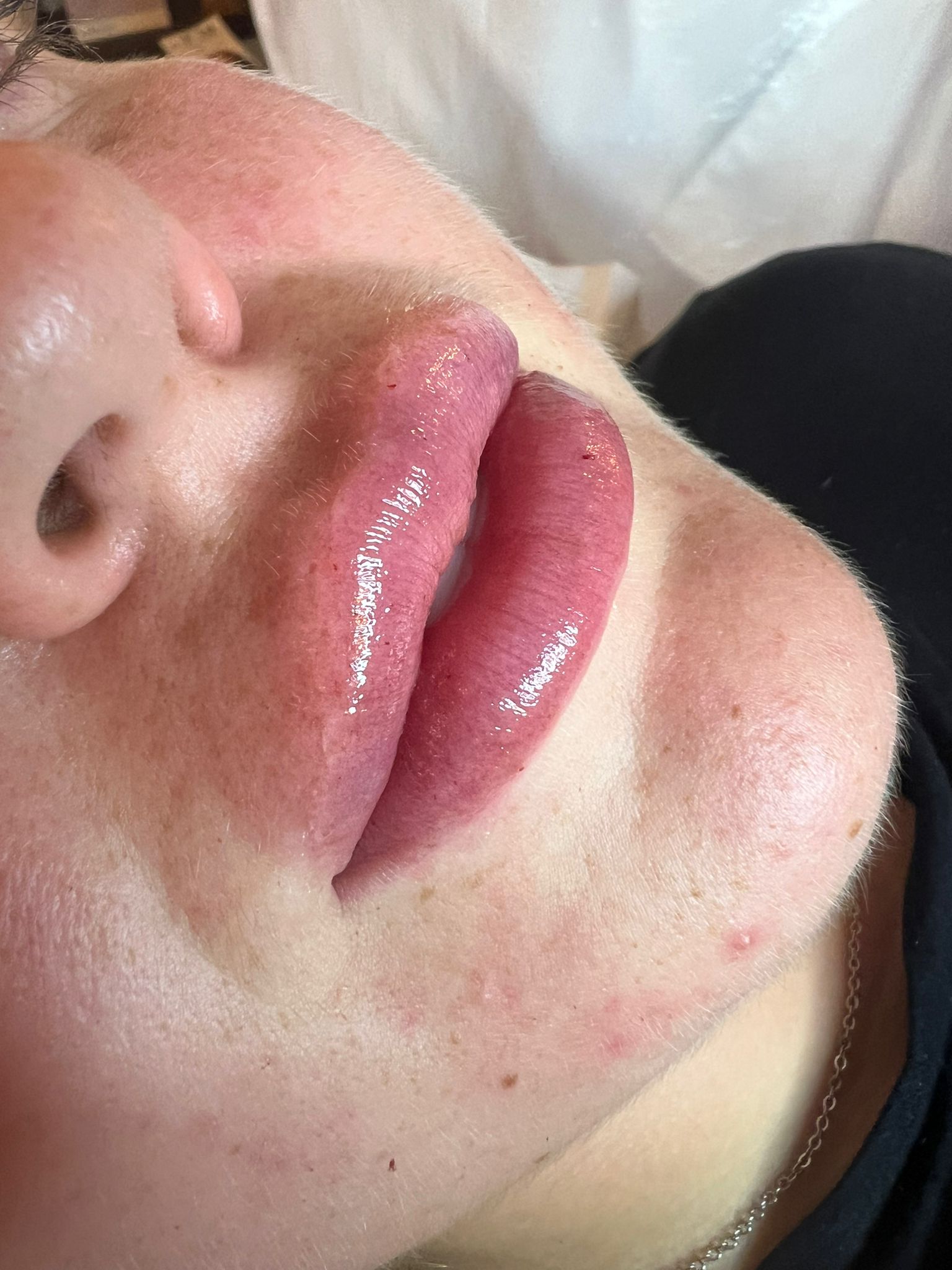 Treatment Visual
